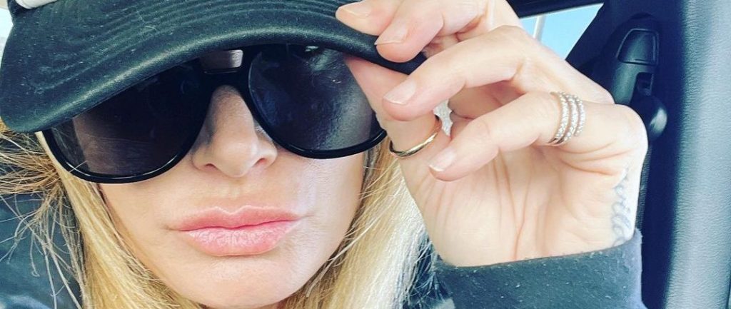 RHOBH’s Eden Sassoon Refutes Claims Her Dog Viciously Attacked and Disfigured L.A. Woman